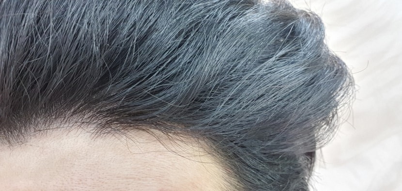 오른쪽 부분