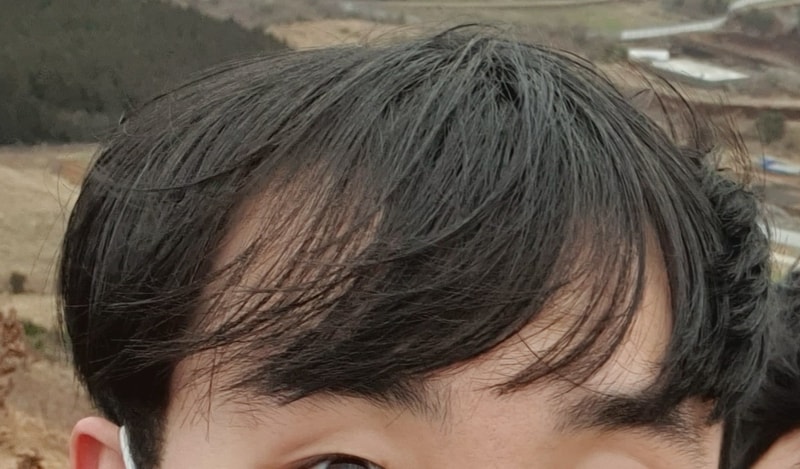 약과 이식..꽤나 큰변화였네요