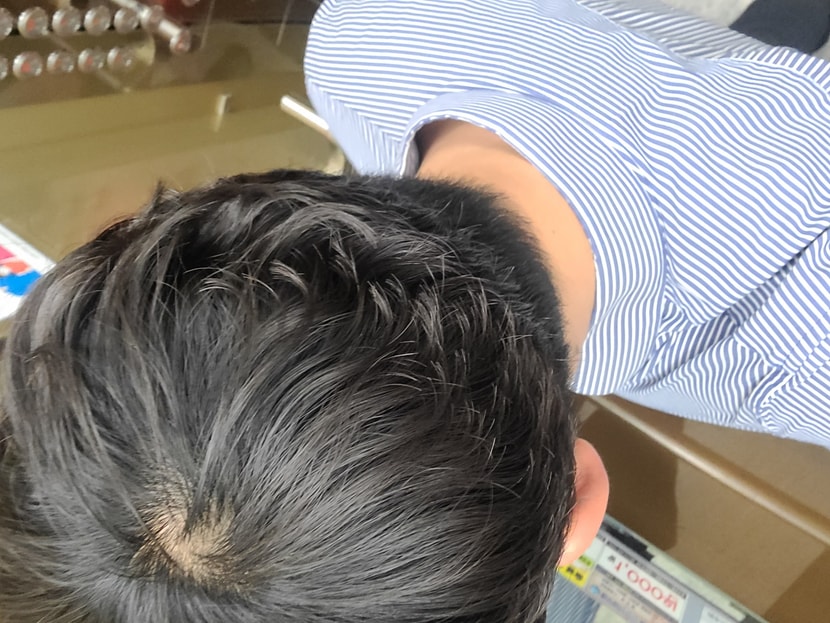 정수리