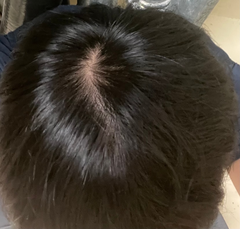 정수리 사진