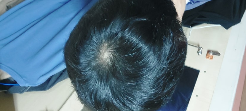 최대한 풀면 이정도.. 아마.중심을.시작으로 주변이.점점 빠지는 게.보일겁니다