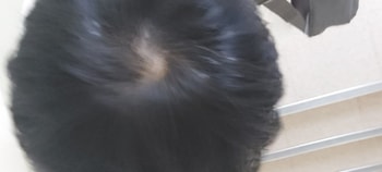 잘 감춘 경우..ㅜㅜ