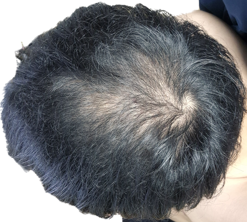 현재