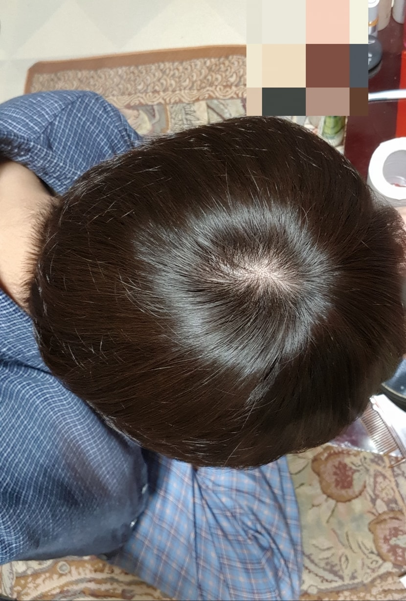 형광등 2