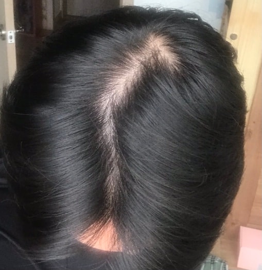 薬を乗り換えるかどうか悩んでいます