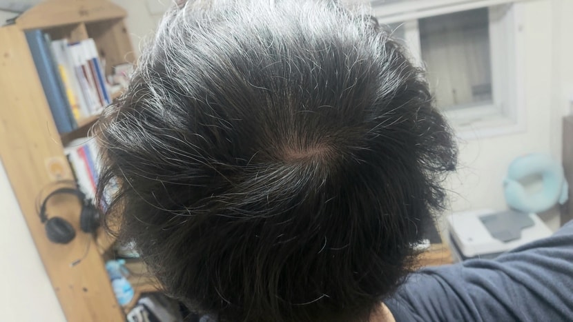 현재 1
