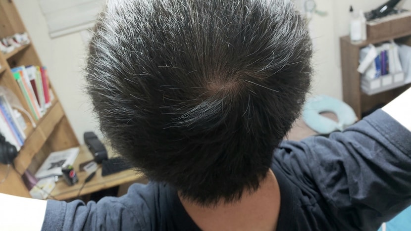 삭발 1