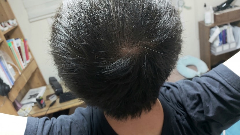 삭발 1
