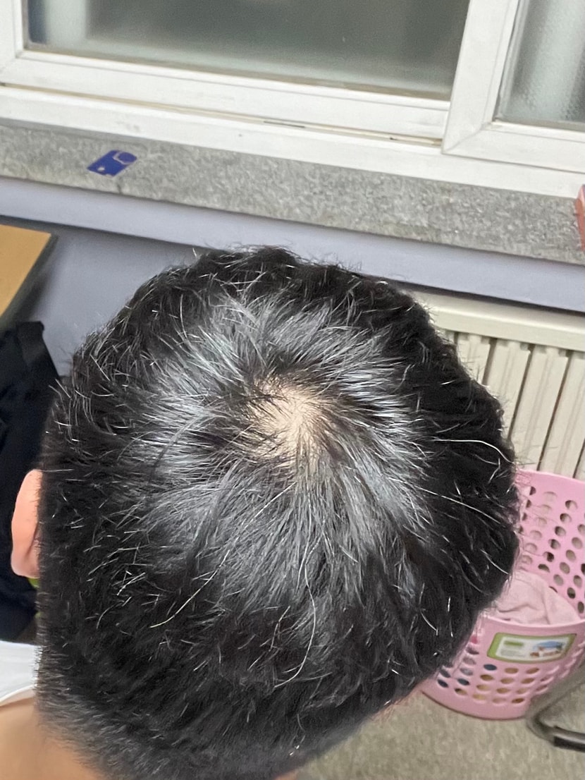 두 사진모두 형광등 바로 아래에서 촬영한 사진입니다