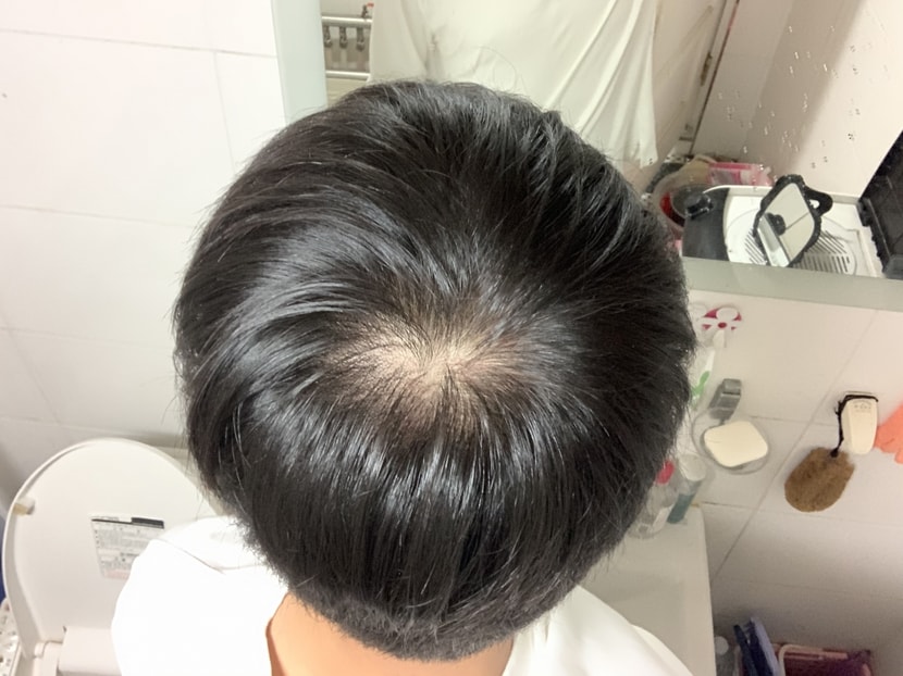 약 복용 초장기 때
