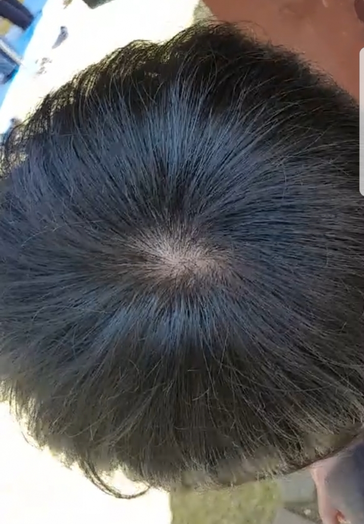 이게 두달전이고