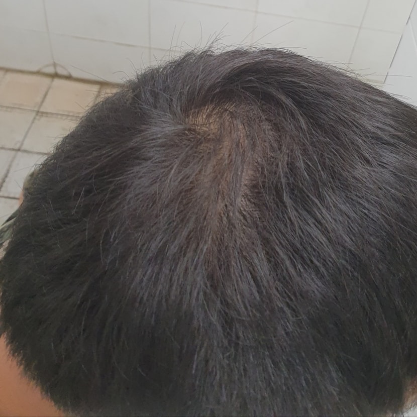 오른 대각선