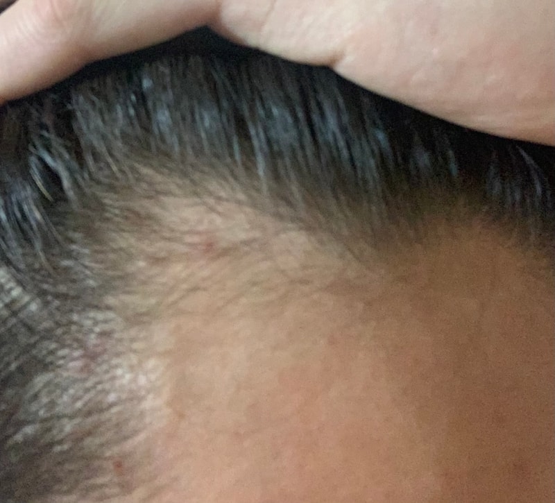 第8个月时m字无效