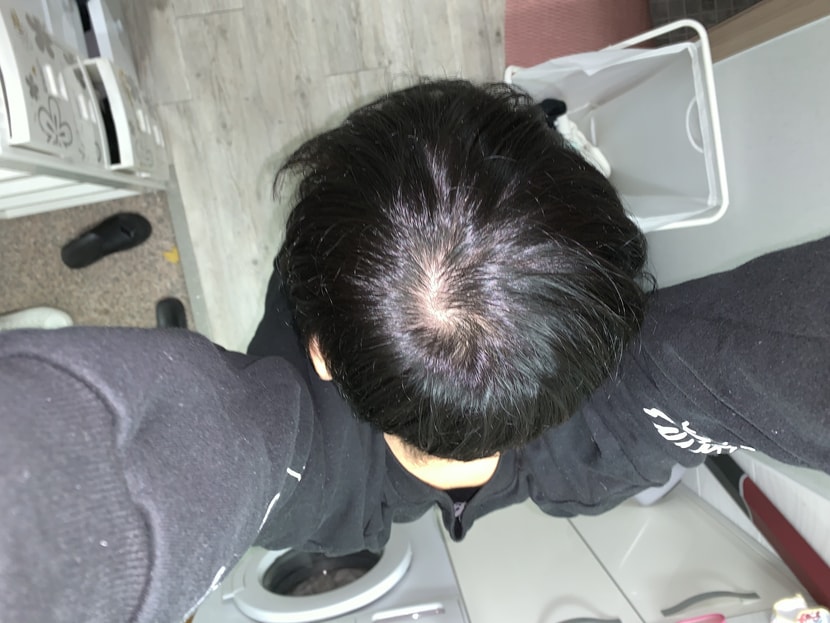 머리 감기 전 2