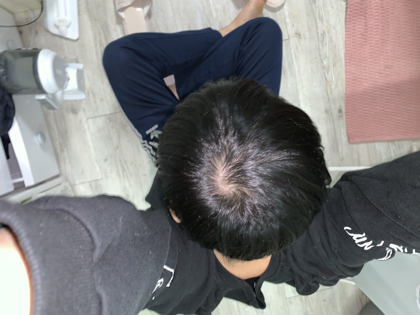 머리 감기 전 3