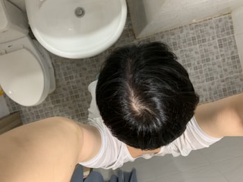 도포 후 2