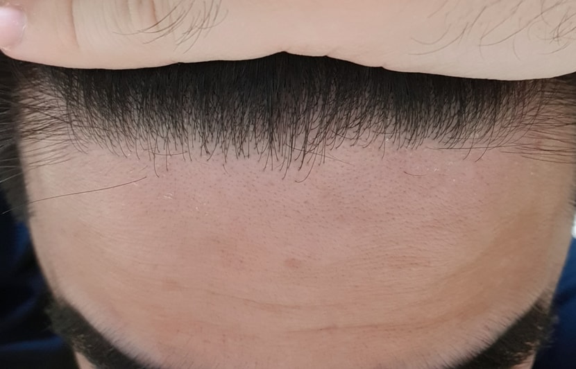 24년 3월 27일 앞머리 상태 뒤로 올림
