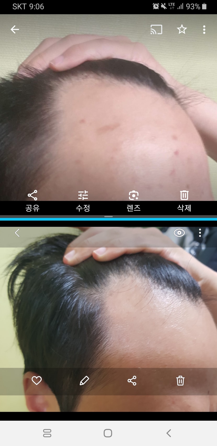 2년전과 지금