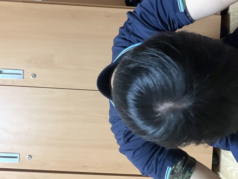 작년 8월(약 바르기전)