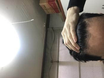 8년전 사진인데 요즘 숱이랑 앞머리 갈라지고 있습니다. 