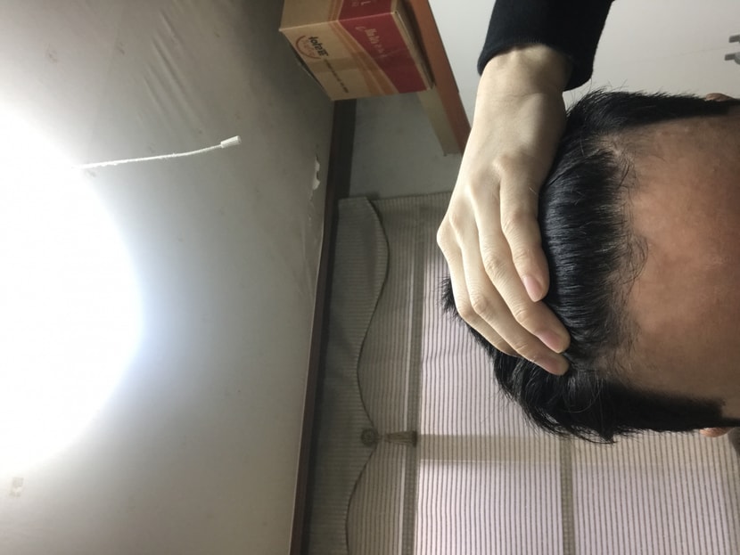 8년전 사진인데 요즘 숱이랑 앞머리 갈라지고 있습니다. 
