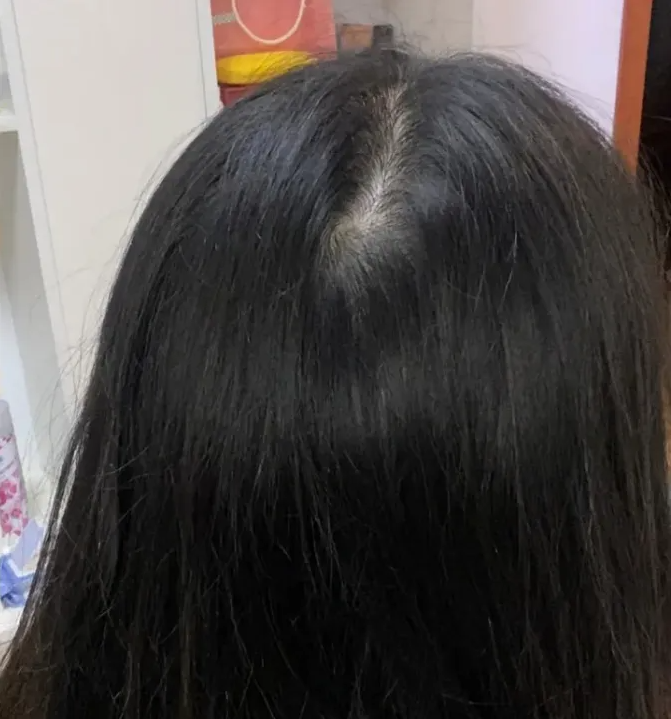 欲張って血を見ました