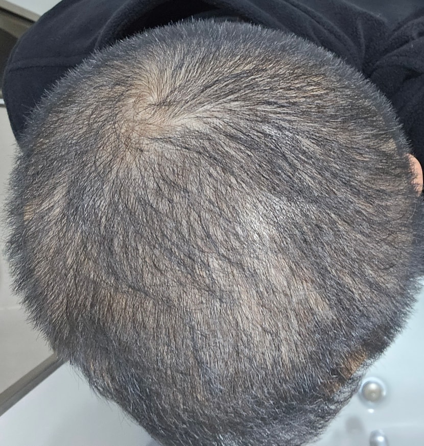 30대