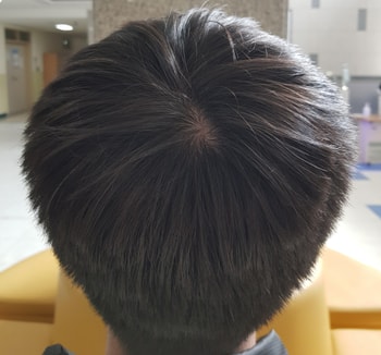 23년 3월 28일 정수리