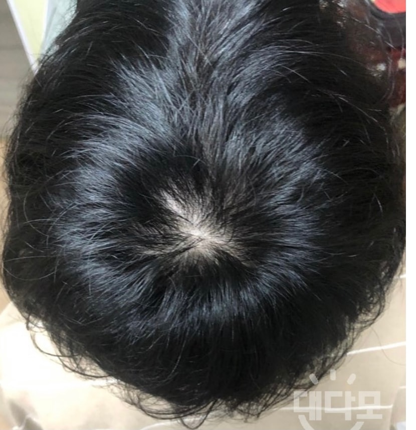 복용전 