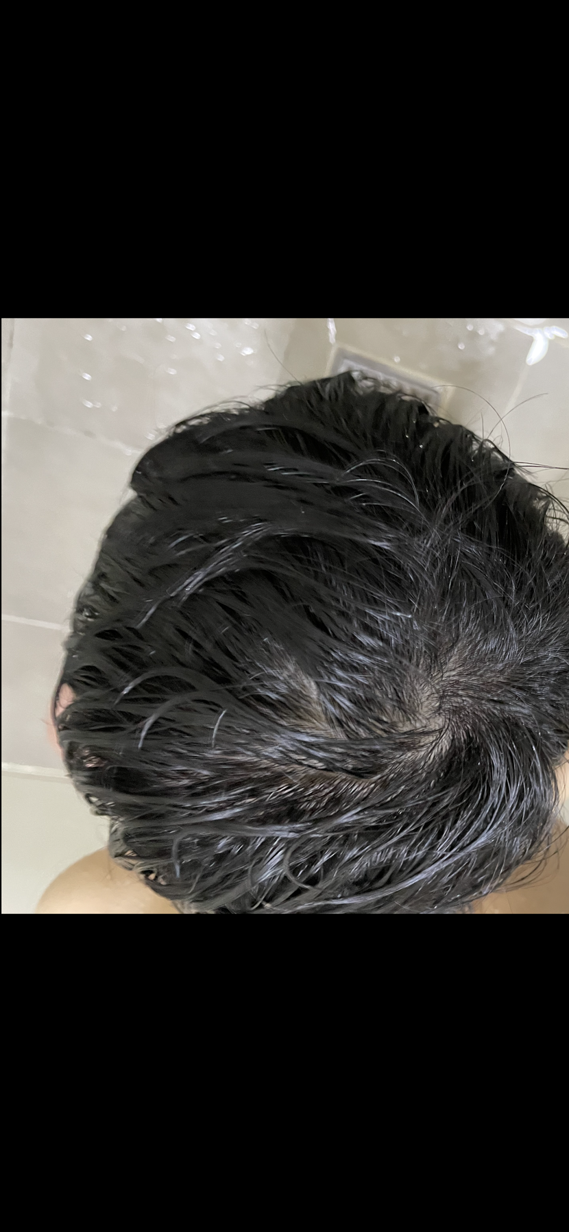 1년 복용후 젖은머리