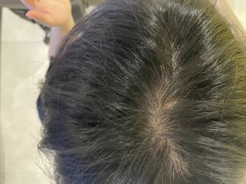 가르마 탄 정수리 모습