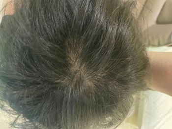 스타일 안한 정수리 모습