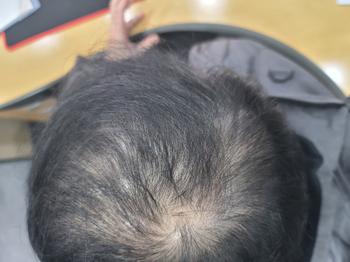 22년 1월 10일 정수리