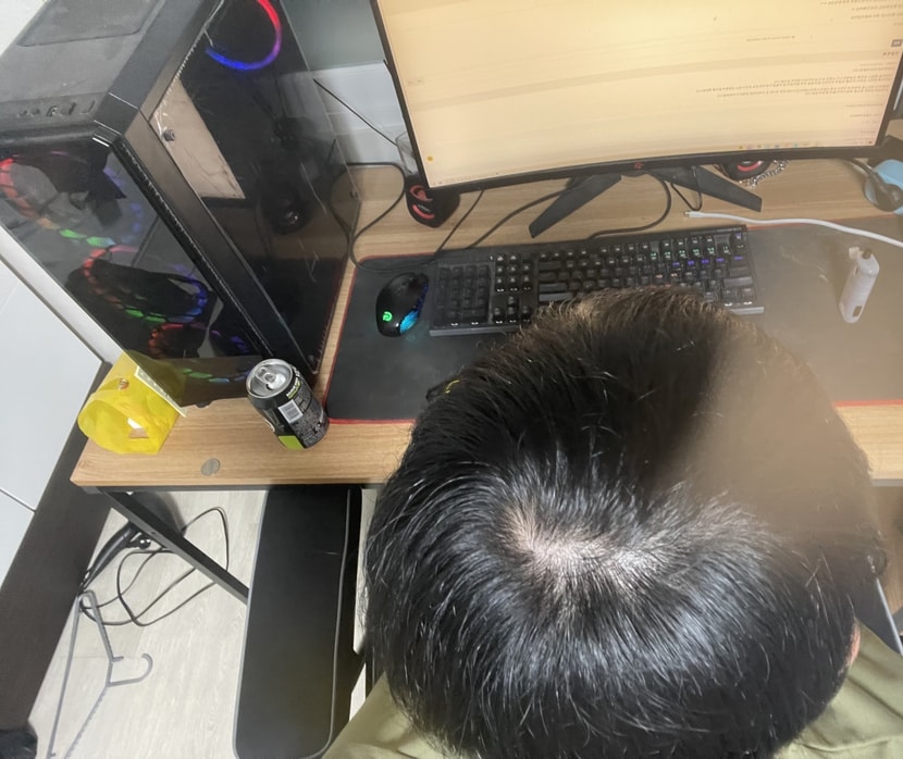 우연히 정수리를 봤는데 너무 비어보여서 긴가민가 하네요;;