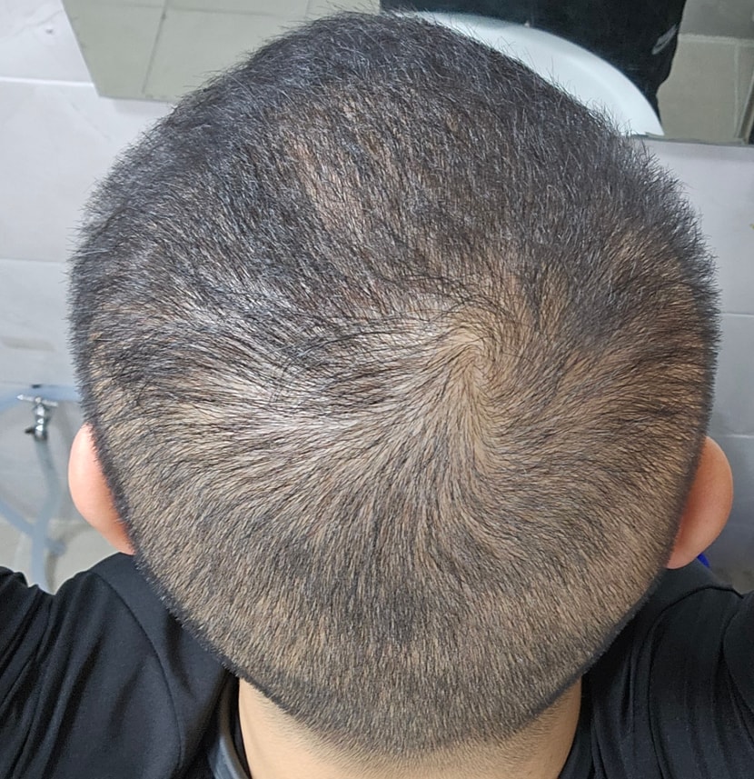 현재