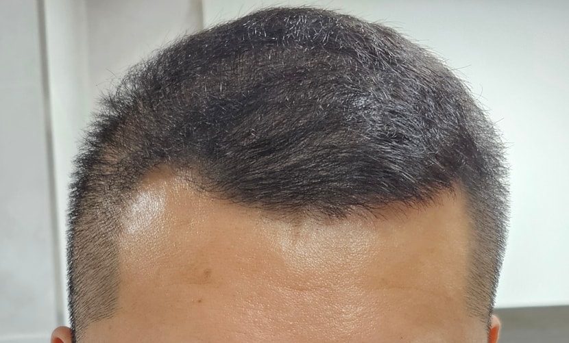 현재