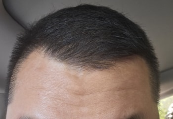 현재