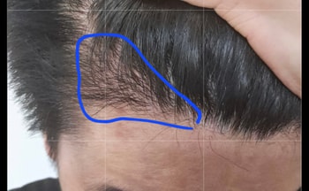 지금
