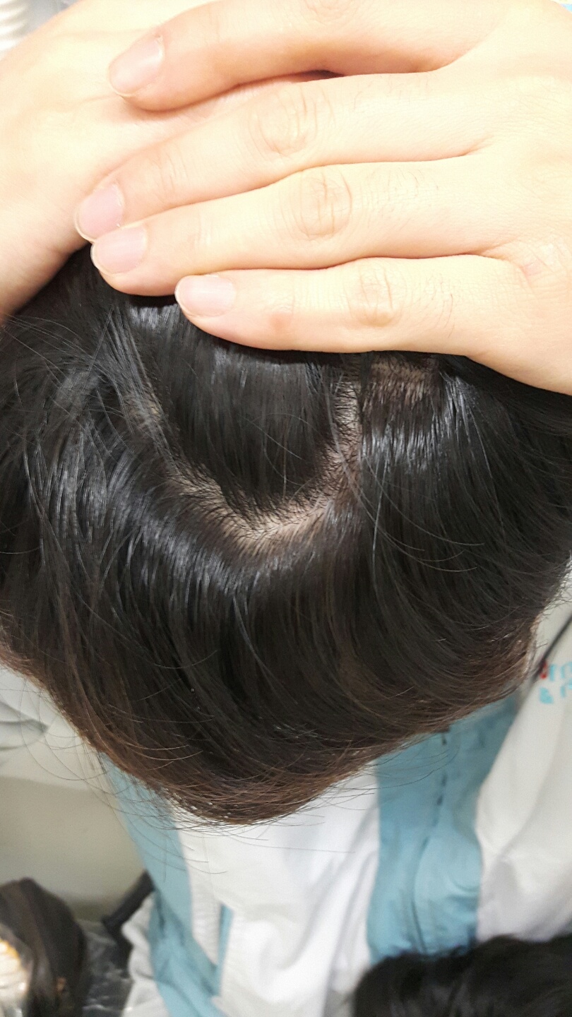 앞머리