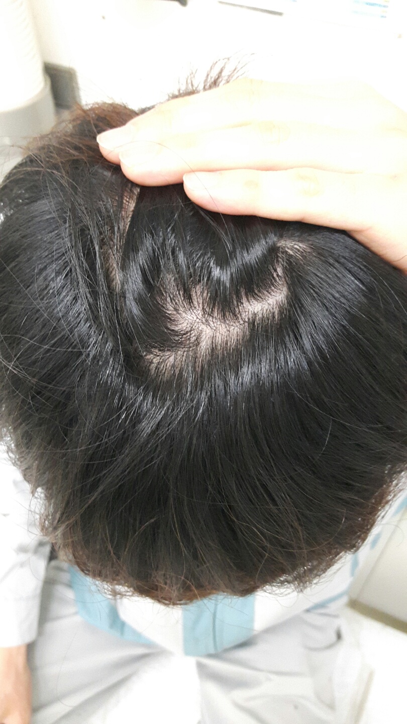정수리