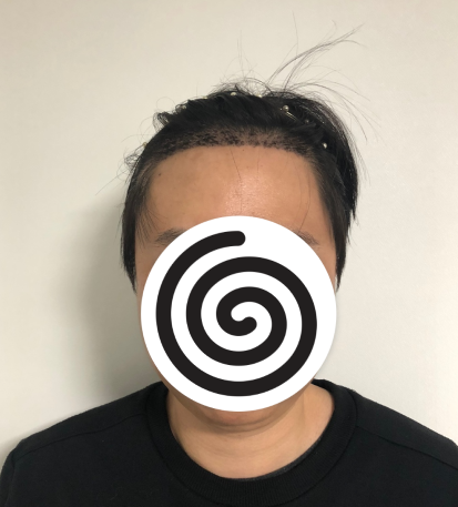 앞모습