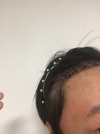 확대