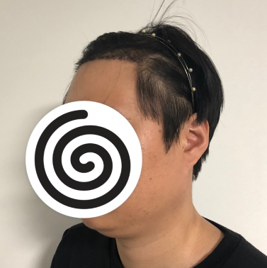 오른쪽