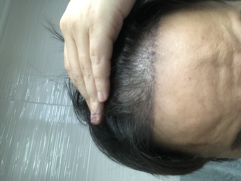 현재