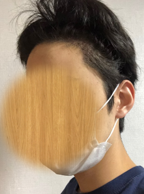 수술 후 머리