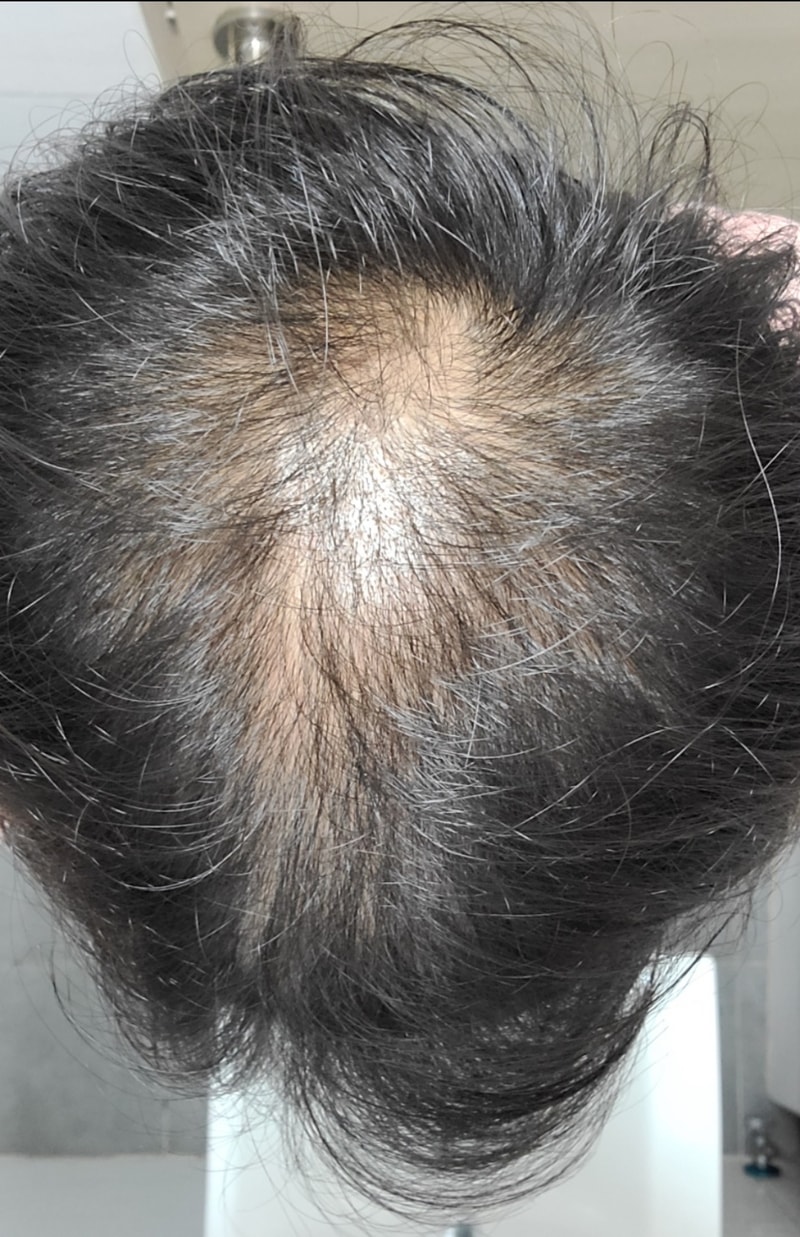 아보다트 후기입니다.(21.05 ~ )