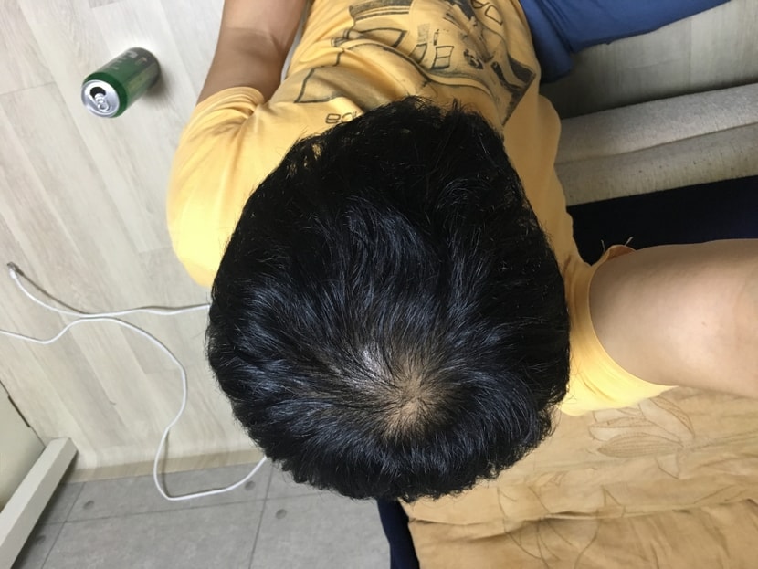 정수리