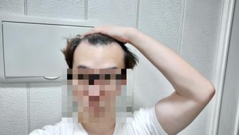 수술 전 1번