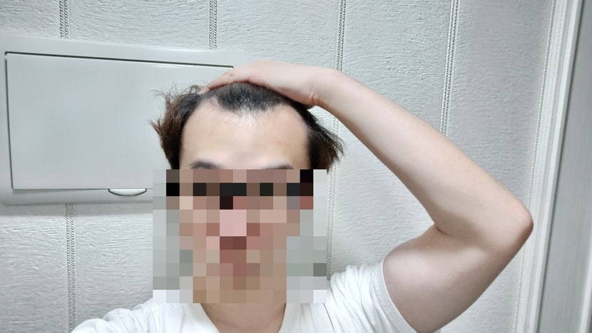수술 전 1번