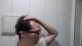 수술 전 3번